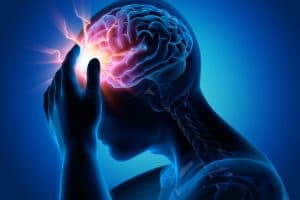 אי אבחון אפילפסיה