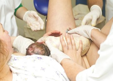רשלנות רפואית בלידה – נזק מוחי בלידה על רקע תשניק סב לידתי