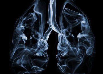 תביעה ייצוגית פרשת טיפול גמילה מעישון
