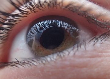 אובדן ראיה בעקבות אי אבחון זיהום בעין