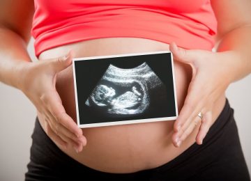 תביעת רשלנות רפואית במעקב הריון